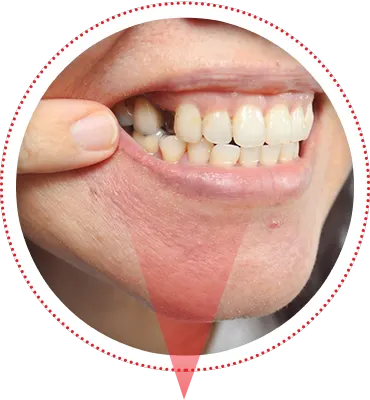 Oral-care concerns illustration from supplied marketing archive